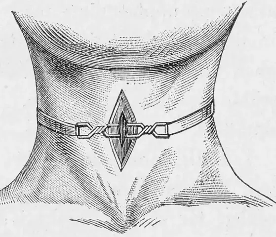Illustration ur Läkarebok för alla : hälso- och sjukvårdslära i populär form (1893), sida 51