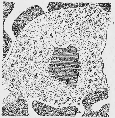 Illustration ur Läkarebok för alla : hälso- och sjukvårdslära i populär form (1893), sida 53