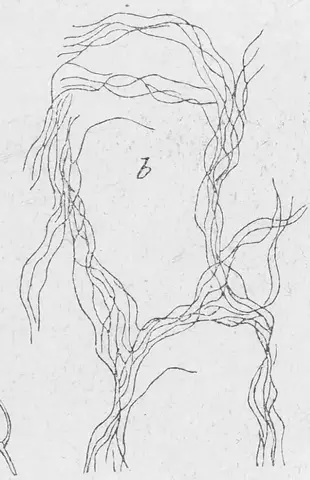 Illustration ur Läkarebok för alla : hälso- och sjukvårdslära i populär form (1893), sida 97
